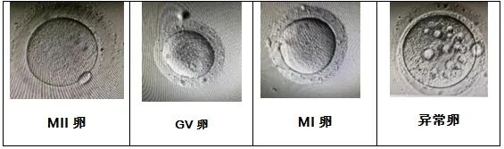 取卵多VS取卵少,哪个试管成功率更高?