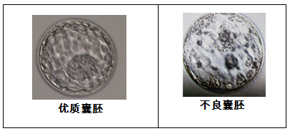 取卵多VS取卵少,哪个试管成功率更高?