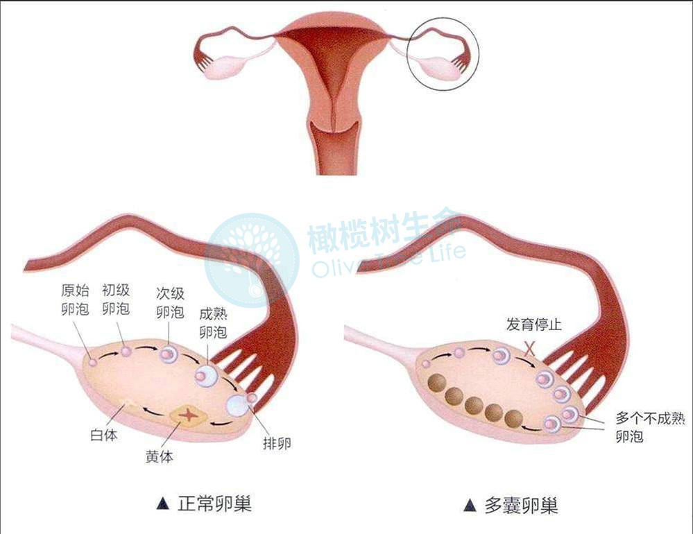 卵巢囊性结构图片