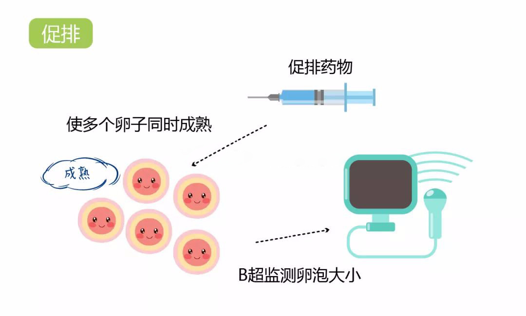 国外试管婴儿为什么要进行卵泡监测呢？