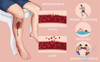 世界血友病日| 用三代试管婴儿技术破解“血之诅咒”！