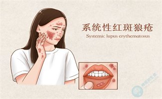 系统性红斑狼疮患者还能做试管助孕吗？