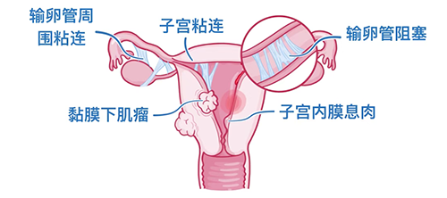 试管备孕中途止步，背后藏着哪些原因？